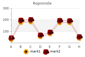 purchase ropinirole 2 mg with mastercard