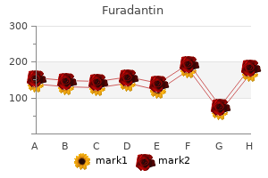 cheap 50 mg furadantin amex